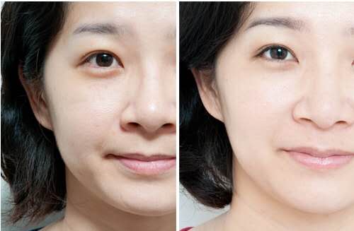 赶紧收藏:在广州有那些医院有热玛吉授权?热玛吉做完到底会不会痛