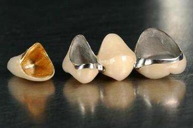 5000块能做烤瓷牙吗?做完果怎么样?