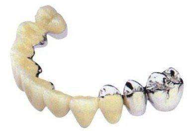 5000块能做烤瓷牙吗?做完果怎么样?