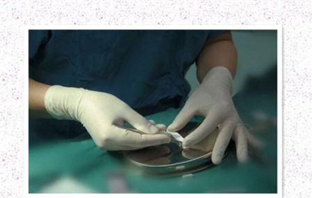 为什么近两年膨体隆鼻的不多?我想可能是这个原因