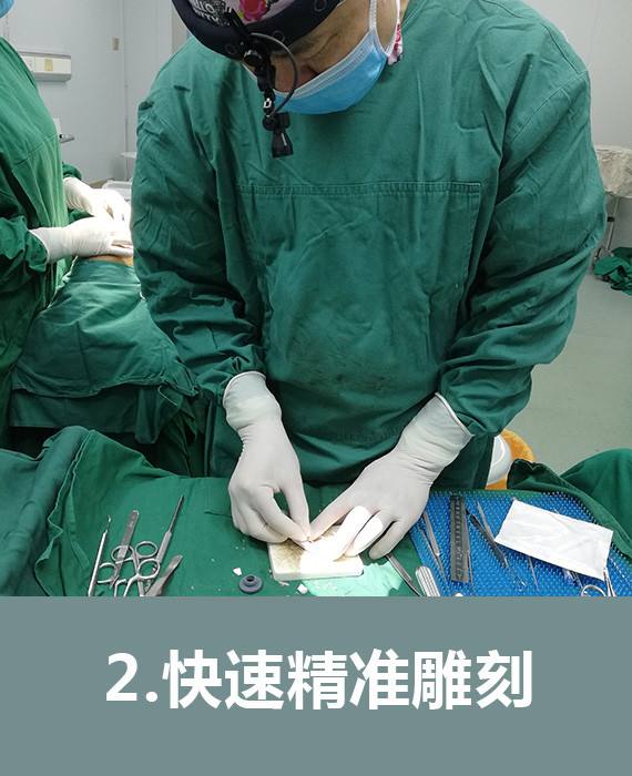 为什么近两年膨体隆鼻的不多?我想可能是这个原因