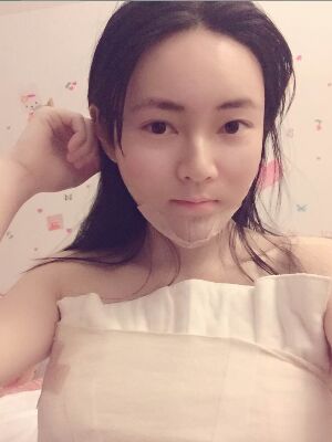 据报道说:称做一次脂肪填充面部,整个人都魅力无限大