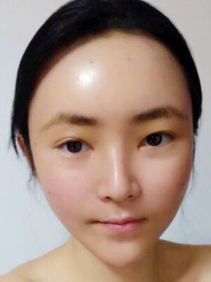 据报道说:称做一次脂肪填充面部,整个人都魅力无限大