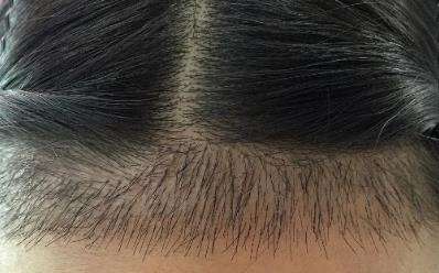 成都瑞丽诗整形医院到底怎么样?专家团队_案例介绍_价格