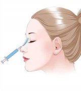 注射隆鼻要多少钱？项目介绍和优缺点盘点