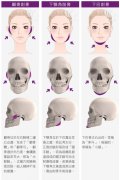 下颚前凸项目介绍,价格是多少？附案例展示