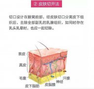 吸脂去副乳要多少钱?果好不好?项目介绍和优缺点盘点