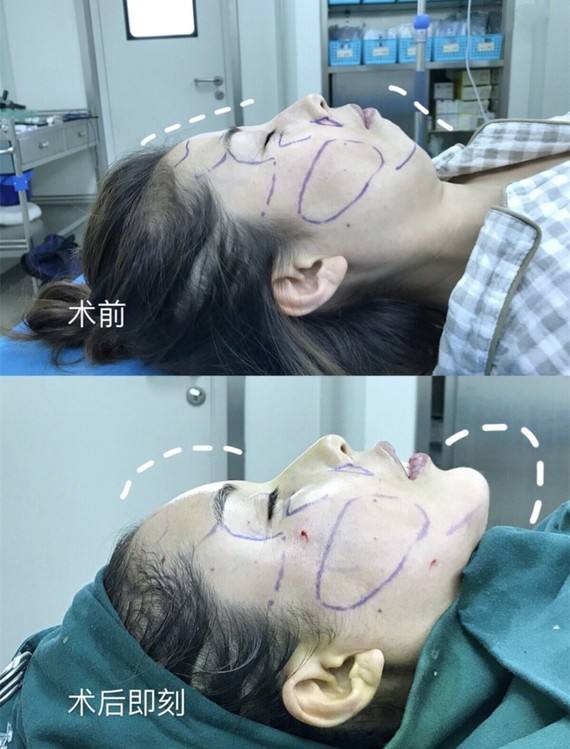 许黎平医生擅长项目是什么？案例展示和个人主页