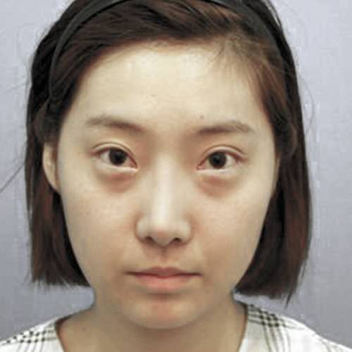 整形专家朱凯林怎么样？案例展示和个人主页