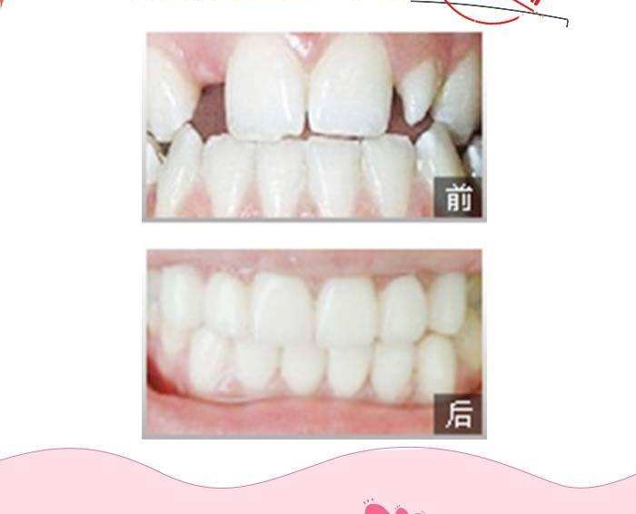 顾菁医生擅长项目是什么？案例展示和个人主页