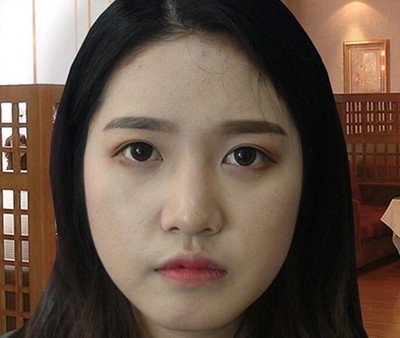 不要太夸张,这在金泰永医生做的鼻子太好了