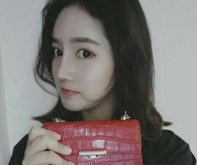 不要太夸张,这在金泰永医生做的鼻子太好了