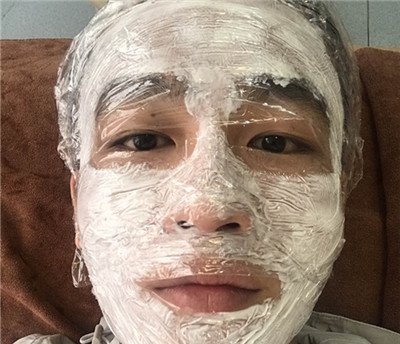 困扰了男友十几年的老痘坑,在武汉艺星就这么治好了?