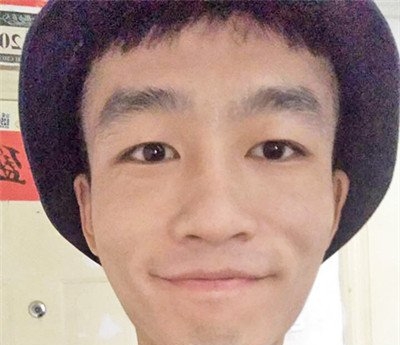 困扰了男友十几年的老痘坑,在武汉艺星就这么治好了?