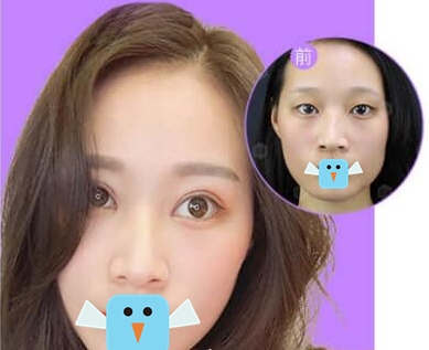 苏州100整形医院如何?案例展示_专家团队介绍_价格