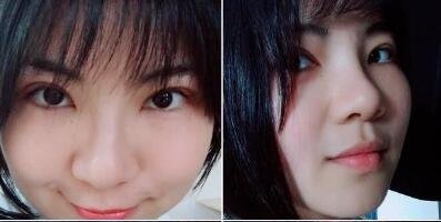 杭州新友好整形医院如何?案例展示_专家团队介绍_价格