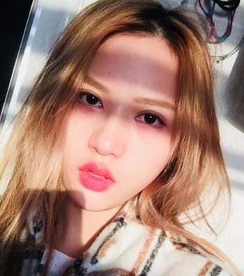 整形专家闫佟技术怎么样?新疆整形医院_个人主页_口碑