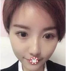 整形专家崔斌技术怎么样?新疆整形医院_个人主页_口碑