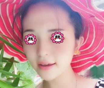 佛山广美美容医院的情况?价格、医院团队和案例展示