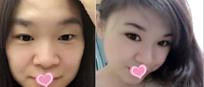 北京圣心整形医院的情况?价格、医院团队和案例展示