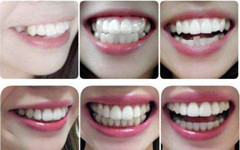 温州伯思立整形医院怎么样?概况和相关案例