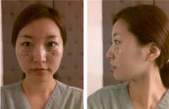 有个秘密|是不是完全看不出来~我的鼻子是do过的