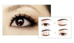 没信心不敢去尝试高风险的减龄项目，不然做个日式双眼皮