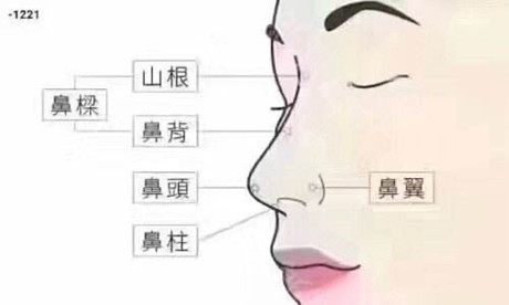 才花2w多在厦门莫琳娜那做的鼻整形,15天后真的是变了一个脸