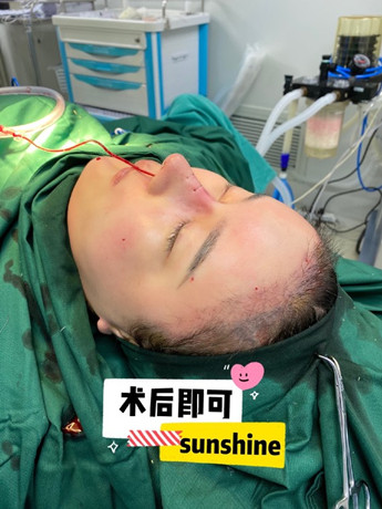 避雷必看|广州隆鼻黑红榜,教你如何去选择对的