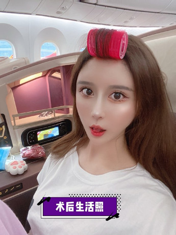 避雷必看|广州隆鼻黑红榜,教你如何去选择对的