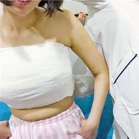 在北京叶子整形做的隆胸,让我直接变成“大”白挺