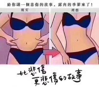 花2w在北京英煌整形郝斌医生那做的腰部吸脂,真的是赚到了