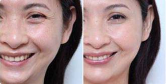 北京正美郑永生医生的相关简介和案例