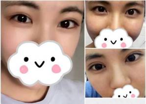 北京正美郑永生医生的相关简介和案例