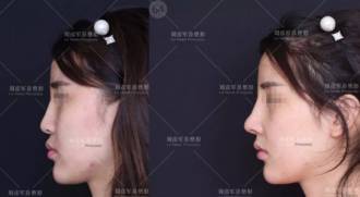 北京沃尔刘彦军医生的相关简介和案例