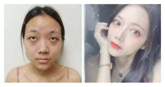 广州华美阮庆玲医生的相关简介和案例