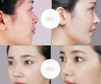 深圳福华医疗美容医院怎么样？医院概况和相关案例