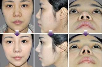 深圳美莱医疗美容医院怎么样？医院概况和相关案例