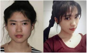 重庆当代整形医院怎么样？医院概况及相关案例