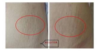 重庆军美医疗美容医院怎么样？医院概况和相关案例