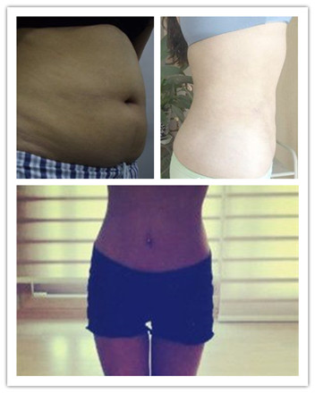 黄石华中福康整形医院的资质如何?专家团队_案例展示_价格