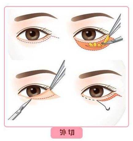 福州瑞丽美容医院到底怎么样?案例展示_专家团队介绍_价格