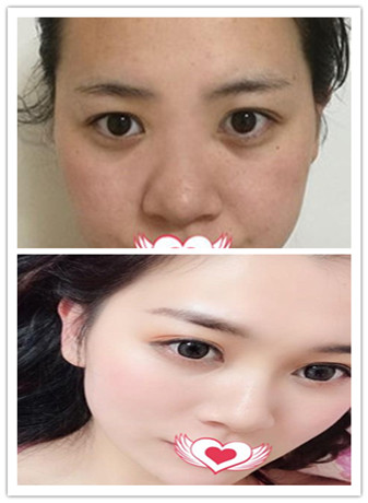 合肥华美整形医院怎么样？口碑、团队和案例