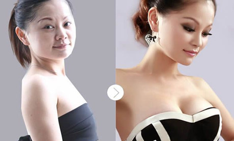 福州名韩整形医院怎么样？值得推荐的医生和案例展示