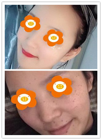 福州海峡整形医院怎么样?值得推荐的医生和案例展示