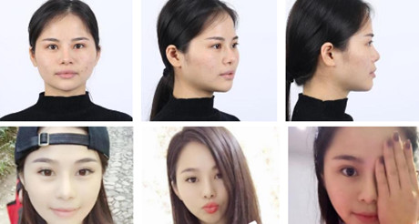 上海时光整形医院怎么样?案例展示、医生团队如何?