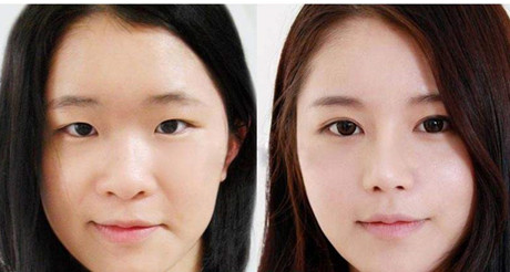 上海伊莱美怎么样？值得推荐的医生和案例展示