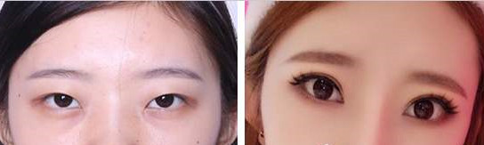 沈阳463整形医院口碑好吗?价格是多少?概况和案例展示