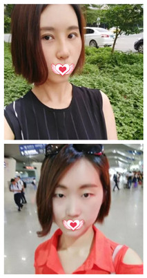 沧州美神整形医院怎么样?价格、口碑和相关案例