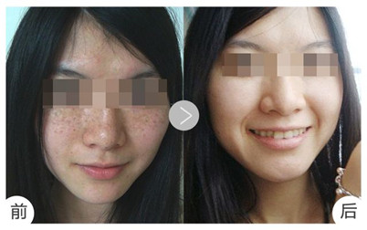 合肥105整形医院怎么样?口碑、价格和相关概况